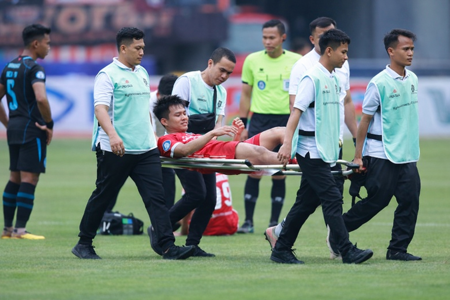 Terobosan Medis: Urat Sintetis Jadi Harapan Baru Pesepak Bola yang Dihantam Cedera ACL